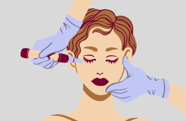 Dermal Fillers