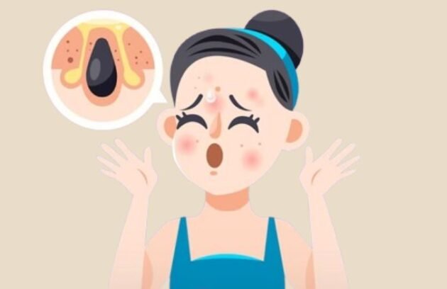 Korean Acne Scar Treatments