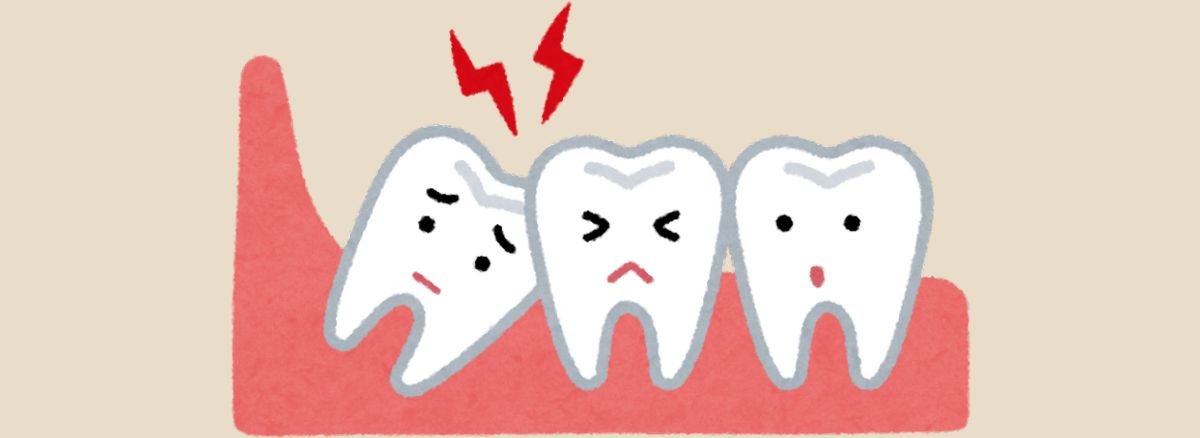 Wisdom Teeth Removal