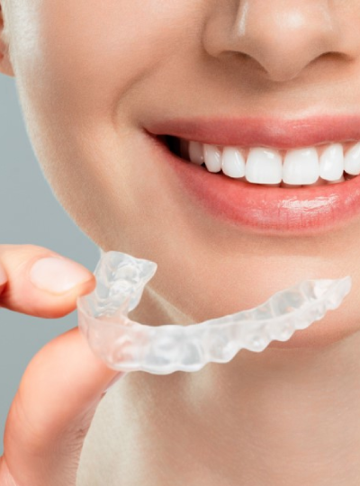 Invisalign